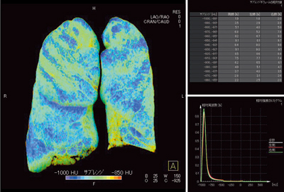 }6@Ǘ1FxCCGOLDUiparenchyma摜̎O\j