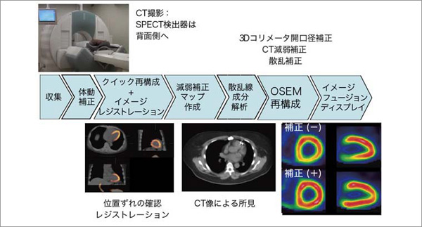 }1@Advanced SPECTECT摜č\