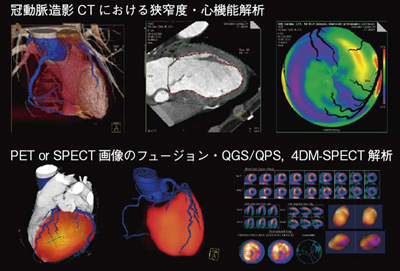 syngo Circulation MI Hybrid Image