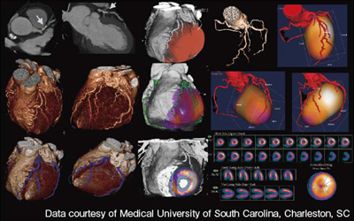 syngo Circulation MI Hybrid Image
