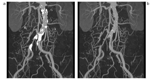 }1@Dual EnergyC[WOɂΊDƌǂ̕