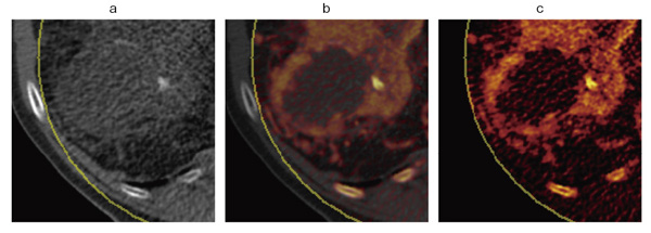 }3@Dual EnergyC[WOɂLiver VNC
