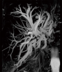 }6@3D-MRCPisyngo SPACE{ PACEj