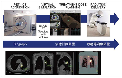 図7　放射線治療計画装置との連携