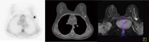 FDG-PET/CT&MRĨt[W