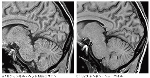 }2@8`lEwbhMatrixRC32`lEwbhRCƂ̔r