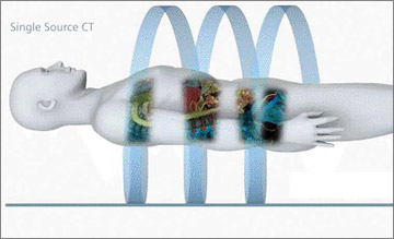 }2@Single Source CT̕`ZO