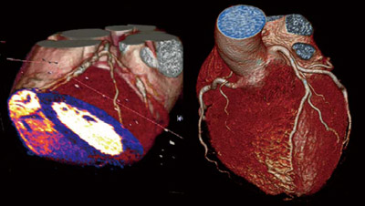 }4@SOMATOM Definition Flash̗Տ摜