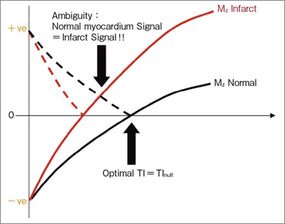 図1　Phase Sensitive IR法と既存法による信号変化の模式図