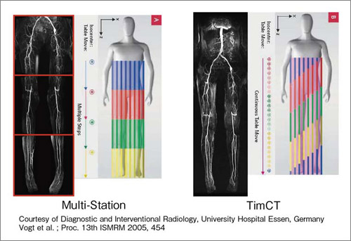 }4@eMRABF}`Xe[V vs. TimCT Angiography