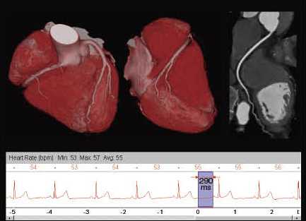 }3@Flash Spiral CardioɂՏ