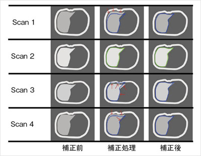 }5@DynaVIBEɂ̑摜̈ʒuY␳