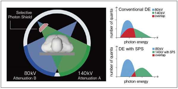図2　Selective Photon Shieldの概念図
