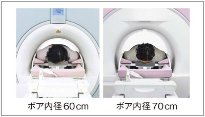 MAMMOMAT Inspiration