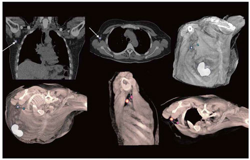 Z`lpߓ]ڂ̌oi摜: Radiology Clinic Parkway Hospitals, Singaporej