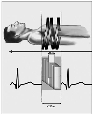 }3@Flash Spiral Cardio sb`3.4C460mm/sȏ̎BexɂC ĝ݂^[QbgɂBe\B̂Ƃ̎ԕ\75msB