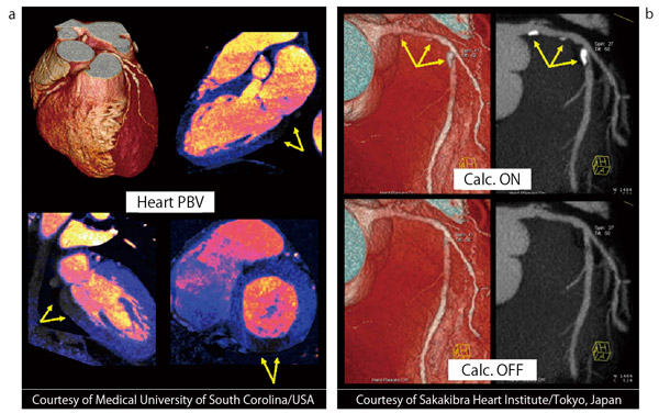 }4@SdDual EnergyC[WO aF75msԕ\3D摜ƐS،摜i󗬈悪`oj bFBone RemovalpΊD摜iij 