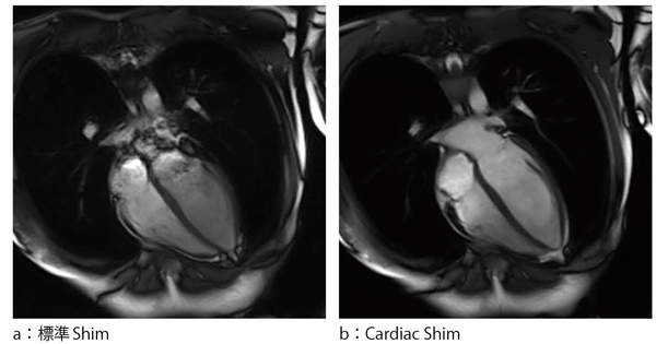 図1　標準ShimとCardiac Shim後の画像比較（TrueFISP） 心臓検査に特化したCardiac Shim（b）では心腔内がより均一に描出されている。