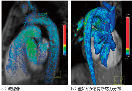 }2@4D Flowł̏o͉摜 zq̗iajCт̏񂩂ǂɂ陒f͕zvZĂibjB