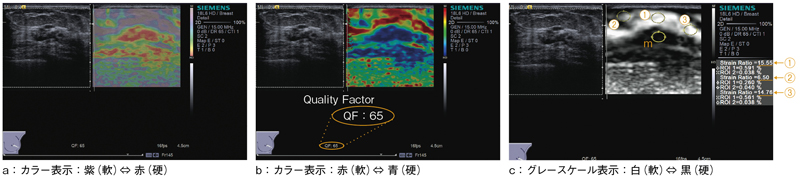 }1@eSie Touch Elasticity Imaging̗iZǊj