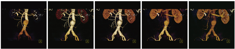 }1@Adaptive 4D Spiral ł4Dɂ錌ǎBe