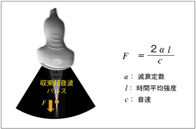 }2@Acoustic Radiation Force Impulse gpXCgDɑ΂ČɉF𔭐B