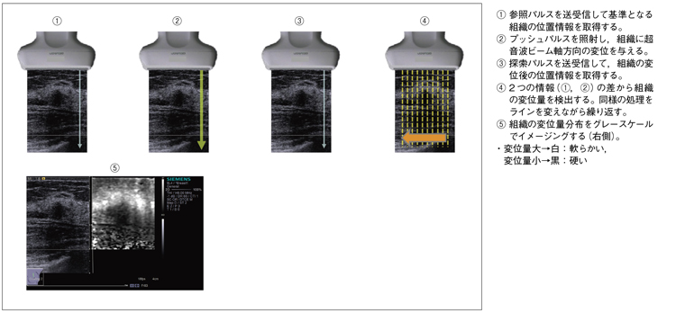 図3　Virtual Touch Tissue Imagingの動作プロセス