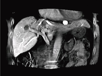 }1@LV DynaCTɂCTAP摜