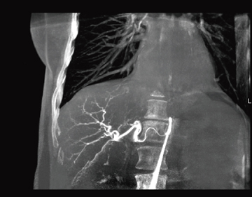 }3@DynaCT 360ɂCTA摜