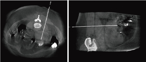 }5@LV DynaCT摜ɂj̏p摜