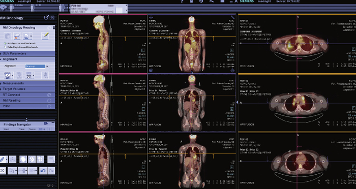 }1@MM Oncology Engine