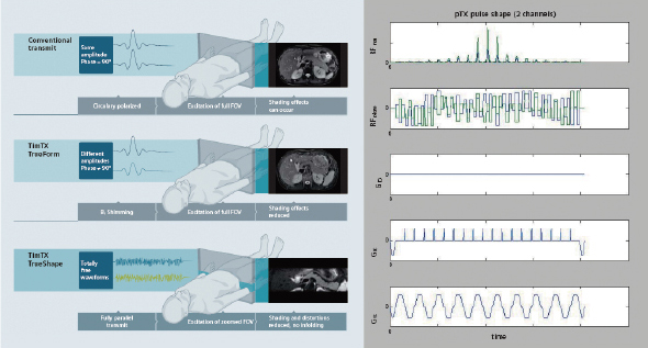 }2@Excitation RF modulation