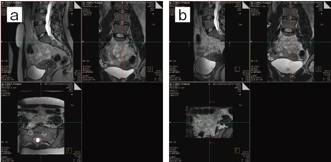 }3@]@F9miniajCZOOMitF6minibj
