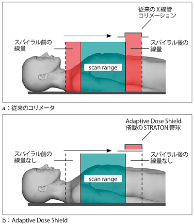 図1 Adaptive Dose Shieldによる無効被ばくの低減
