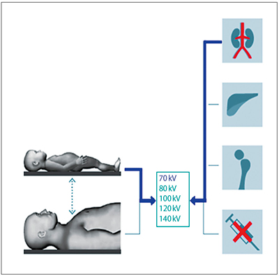 図2 CARE kVの概念図