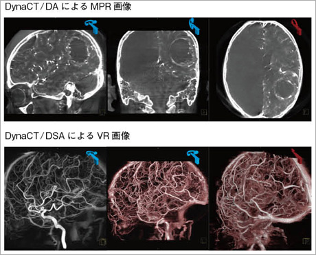 図2　脳腫瘍（造影）