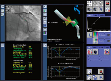 図9　IC3Dによる心臓血管3D表示