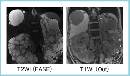 }7@F̗DXEtiADPKDjoߊώ@