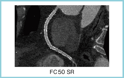 }1@1S̃ALVXLɂ銥CTA