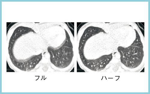 }3@Beł̃{[XLƃn[tč\ɂ鋹摜