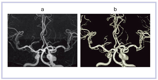 }6@򓮖ᎂMRA aFMIP摜CbF{[_O摜