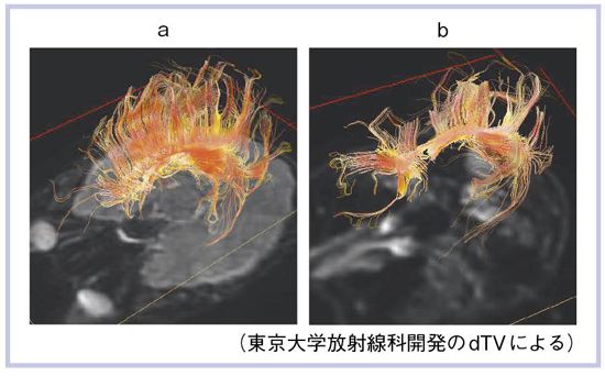 }17@gUe\gNgOtB 3Tiaj1.5Tibj̔r