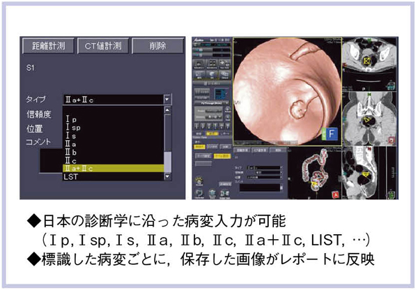 }4@|[g@\ {̐ffwɉaϓ͂\