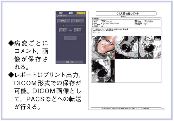 }5@|[gDICOM`ł̕ۑ\