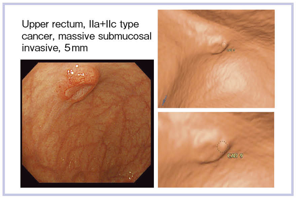 }11@CADɂśEa{Ec^aς̌o