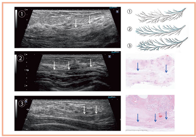 }9@BtEʂ̒g摜ƑgD̑ΔC͎}