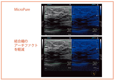 }12@ ΊD̎FɗLpȍŐ[ ՏAvP[V“MicroPure” 
