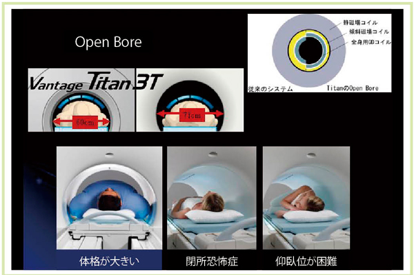 }1@I[v{AVantage Titan 3T