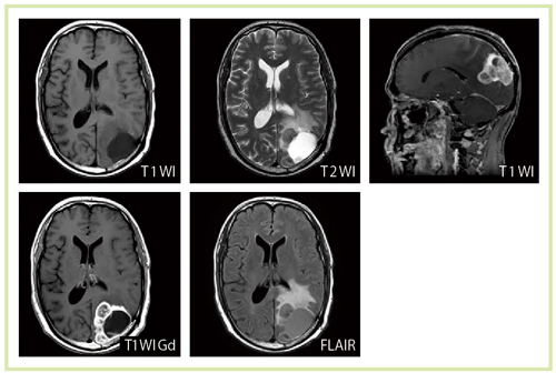 }3@]ᇏǗɂX̃V[PXɂ摜iTitan 3Tj
