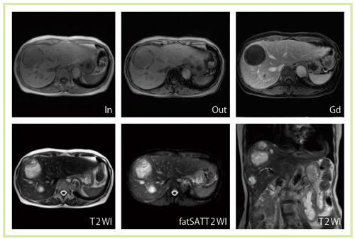 }4@̑̓]ڏǗiTitan 3Tj